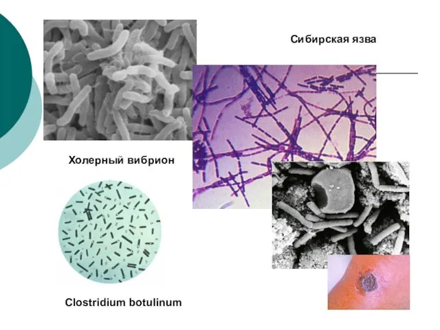 Сибирская язва Clostridium botulinum Холерный вибрион