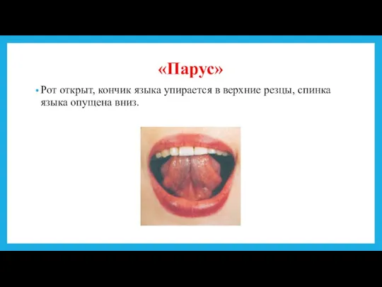 «Парус» Рот открыт, кончик языка упирается в верхние резцы, спинка языка опущена вниз.