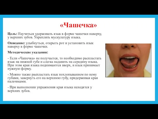 «Чашечка» Цель: Научиться удерживать язык в форме чашечки наверху, у