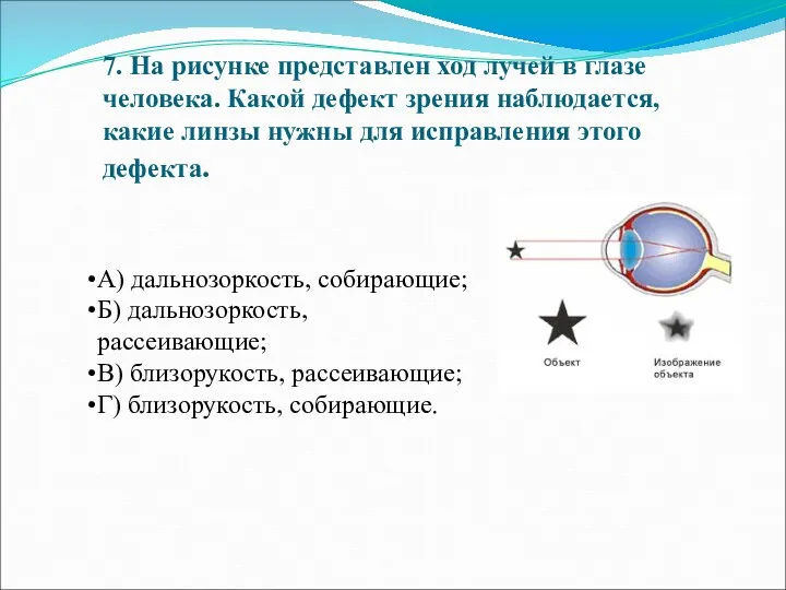 7. На рисунке представлен ход лучей в глазе человека. Какой