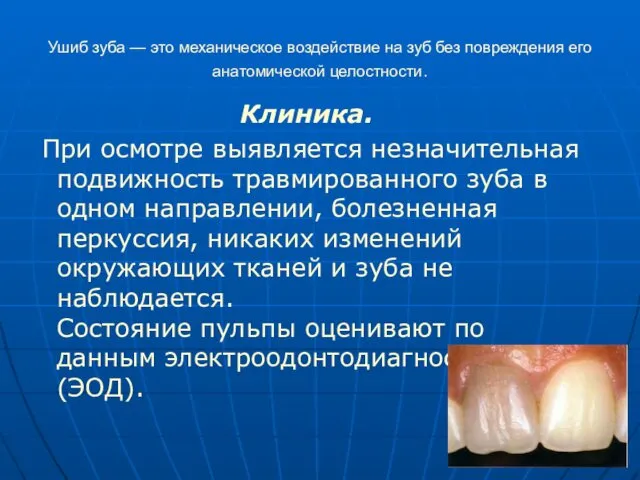 Ушиб зуба — это механическое воздействие на зуб без повреждения