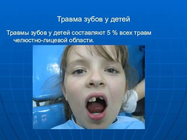 Травма зубов у детей Травмы зубов у детей составляют 5 % всех травм челюстно-лицевой области.
