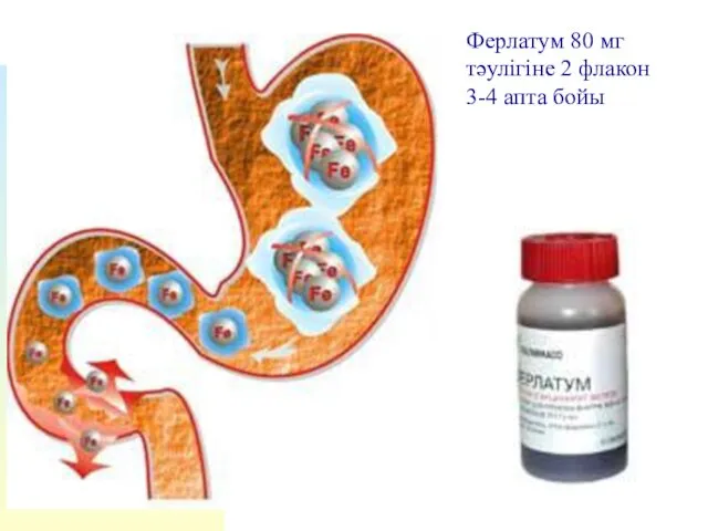 Ферлатум 80 мг тәулігіне 2 флакон 3-4 апта бойы