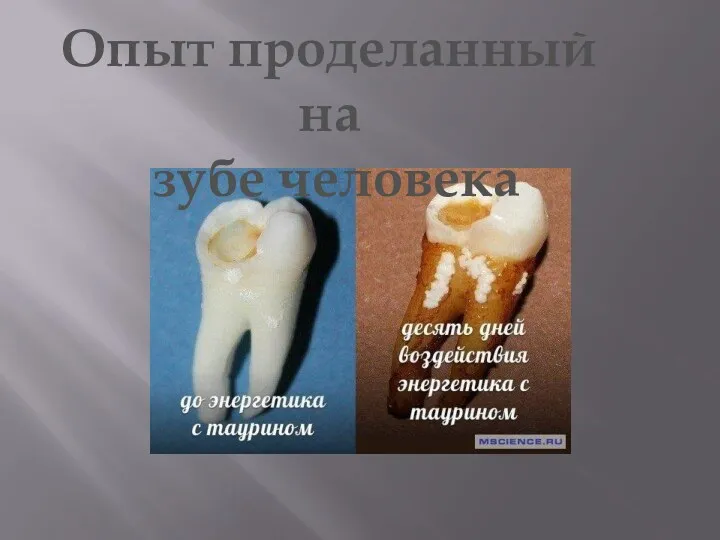 Опыт проделанный на зубе человека