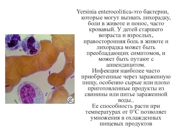 Yersinia enterocolitica-это бактерии, которые могут вызвать лихорадку, боли в животе