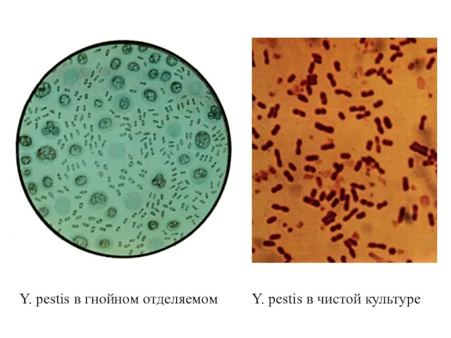 Y. рestis в гнойном отделяемом Y. pestis в чистой культуре