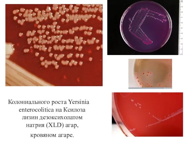 Колониального роста Yersinia enterocolitica на Ксилоза лизин дезоксихолатом натрия (XLD) агар, кровяном агаре.