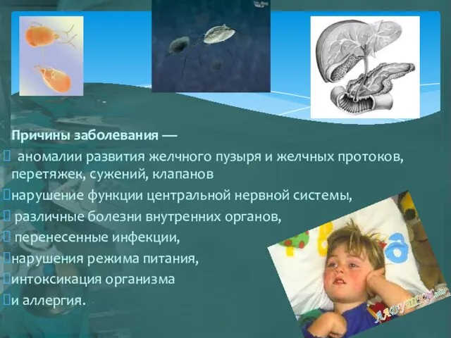 Причины заболевания — аномалии развития желчного пузыря и желчных протоков,