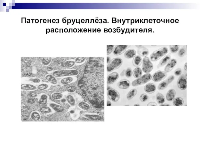 Патогенез бруцеллёза. Внутриклеточное расположение возбудителя.