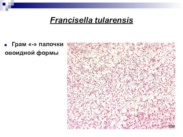 Francisella tularensis Грам «-» палочки овоидной формы