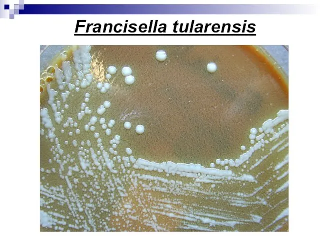 Francisella tularensis