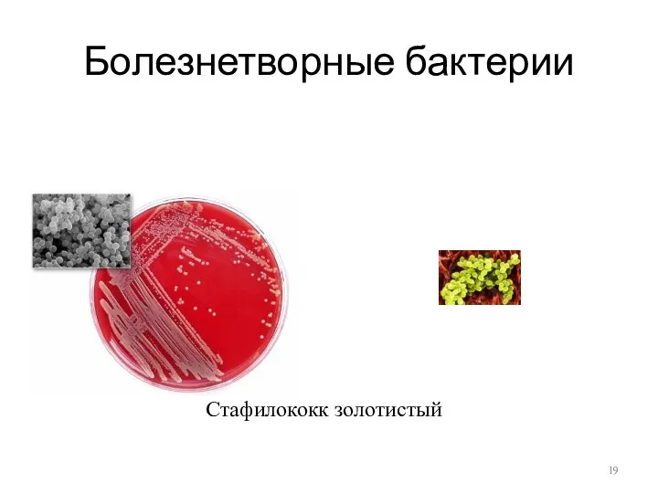 Болезнетворные бактерии Стафилококк золотистый