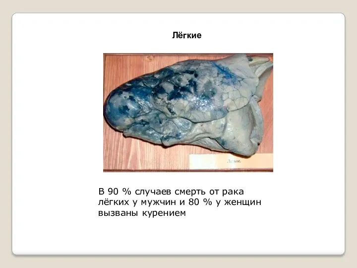 Лёгкие В 90 % случаев смерть от рака лёгких у