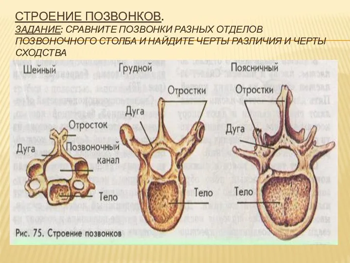 Строение позвонков. Задание: сравните позвонки разных отделов позвоночного столба и найдите черты различия и черты сходства