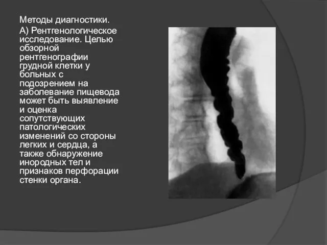 Методы диагностики. А) Рентгенологическое исследование. Целью обзорной рентгенографии грудной клетки