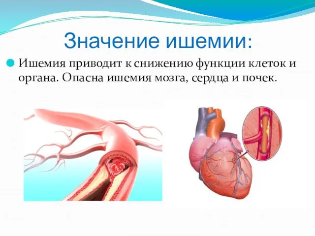 Значение ишемии: Ишемия приводит к снижению функции клеток и органа. Опасна ишемия мозга, сердца и почек.
