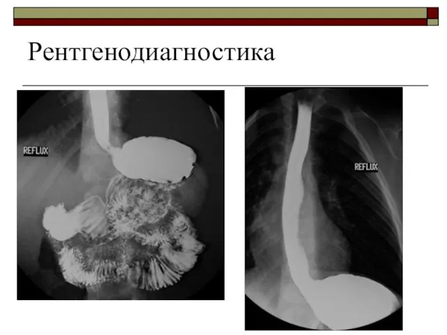 Рентгенодиагностика