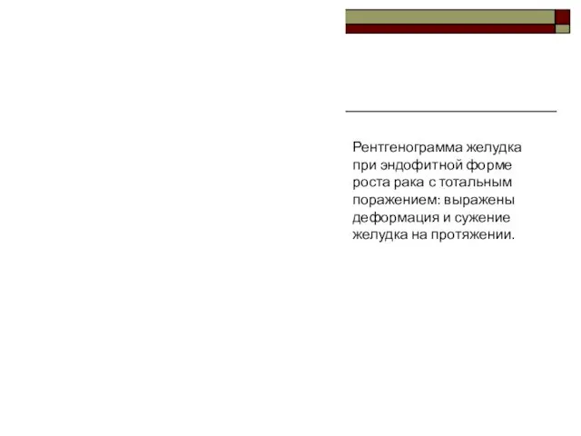 Рентгенограмма желудка при эндофитной форме роста рака с тотальным поражением: