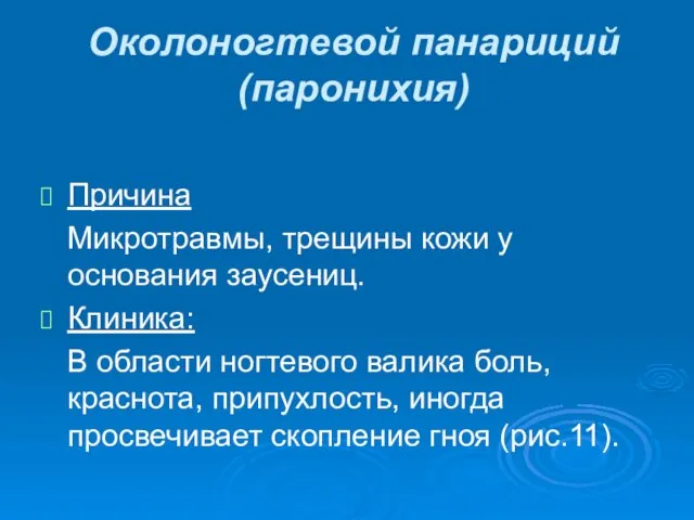 Околоногтевой панариций (паронихия) Причина Микротравмы, трещины кожи у основания заусениц.