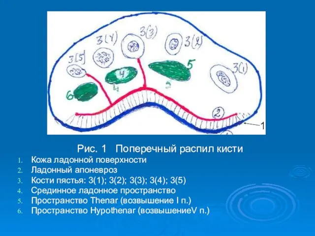 Рис. 1 Поперечный распил кисти Кожа ладонной поверхности Ладонный апоневроз