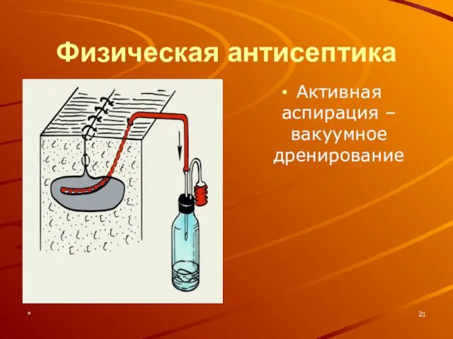 * Физическая антисептика Активная аспирация – вакуумное дренирование