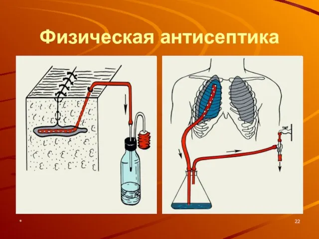 * Физическая антисептика