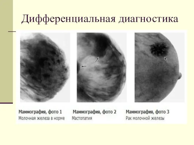 Дифференциальная диагностика