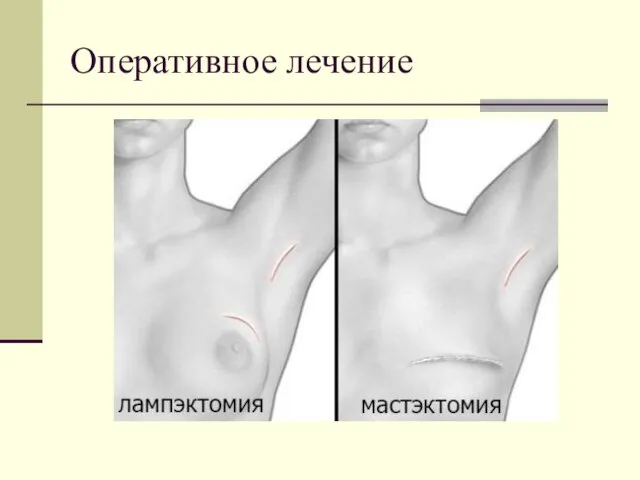 Оперативное лечение