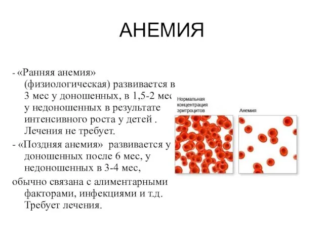 АНЕМИЯ - «Ранняя анемия» (физиологическая) развивается в 3 мес у