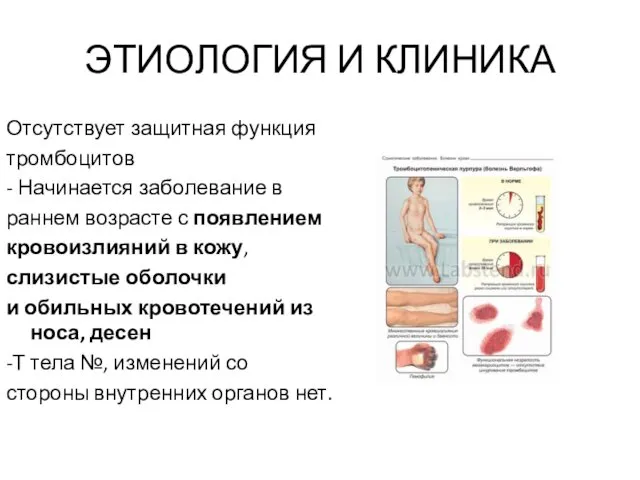 ЭТИОЛОГИЯ И КЛИНИКА Отсутствует защитная функция тромбоцитов - Начинается заболевание