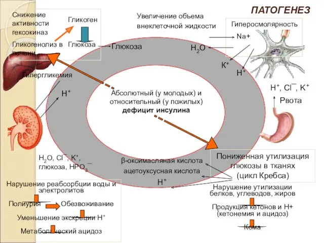 Глюкоза Увеличение объема внеклеточной жидкости Абсолютный (у молодых) и относительный (у пожилых) дефицит