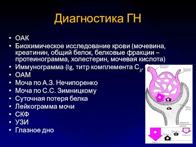 Диагностика ГН ОАК Биохимическое исследование крови (мочевина, креатинин, общий белок,