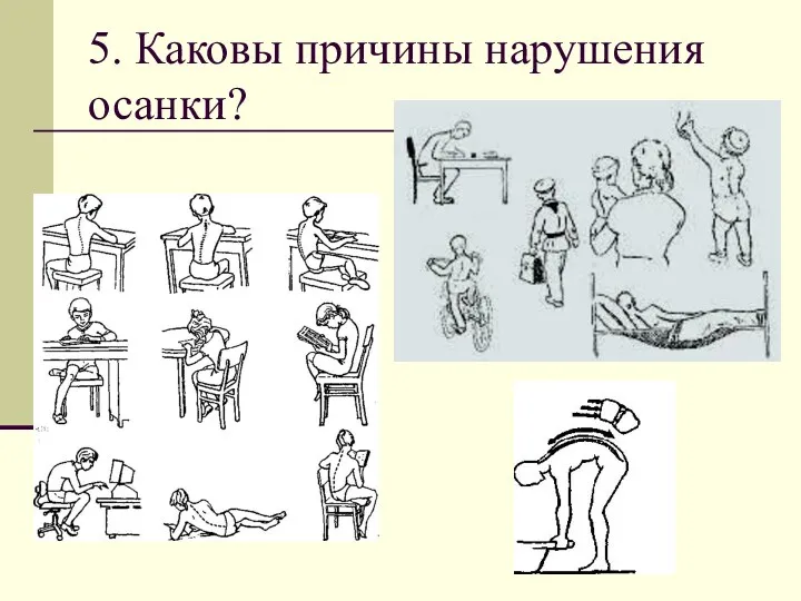 5. Каковы причины нарушения осанки?