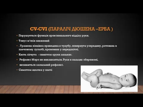 СV-СVI (ПАРАЛІЧ ДЮШЕНА –ЕРБА ) Порушується функція проксимального відділу руки. Тонус м’язів знижений