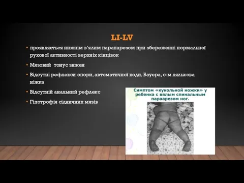 LI-LV проявляється нижнім в’ялим парапарезом при збереженні нормальної рухової активності верхніх кінцівок Мязовий
