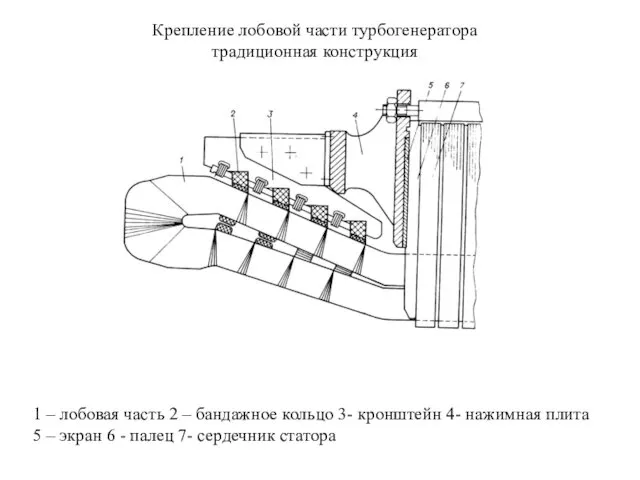 Крепление лобовой части турбогенератора традиционная конструкция 1 – лобовая часть