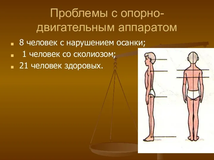 Проблемы с опорно-двигательным аппаратом 8 человек с нарушением осанки; 1 человек со сколиозом; 21 человек здоровых.