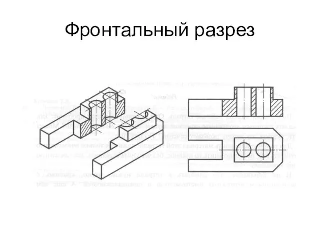 Фронтальный разрез