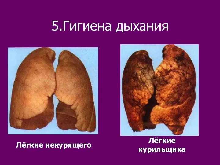 5.Гигиена дыхания Лёгкие некурящего Лёгкие курильщика