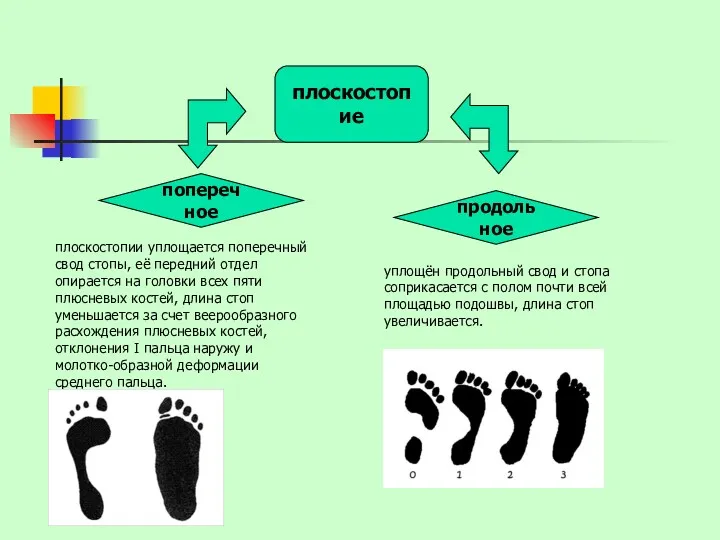 уплощён продольный свод и стопа соприкасается с полом почти всей