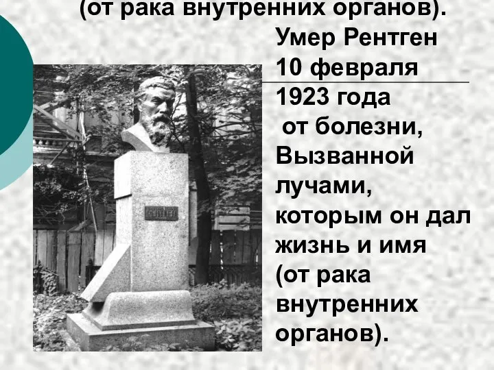 Умер Рентген 10 февраля 1923 года от болезни, Вызванной лучами,