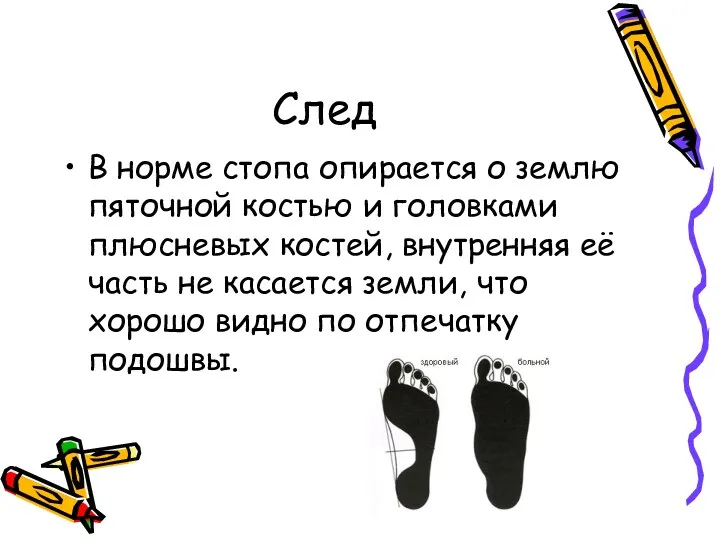 След В норме стопа опирается о землю пяточной костью и