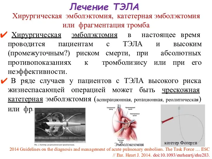 Лечение ТЭЛА Хирургическая эмболэктомия, катетерная эмболэктомия или фрагментация тромба Хирургическая