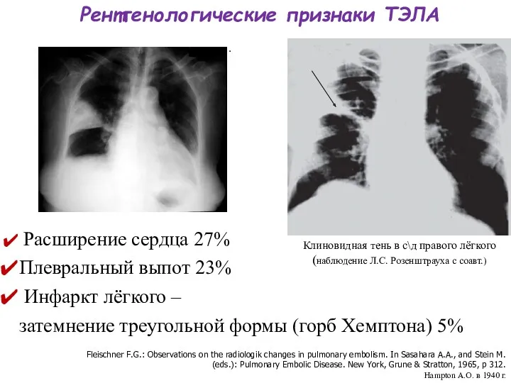 . Fleischner F.G.: Observations on the radiologik changes in pulmonary