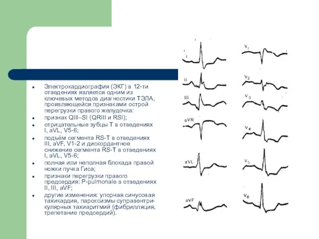 Электрокардиография (ЭКГ) в 12-ти отведениях является одним из ключевых методов