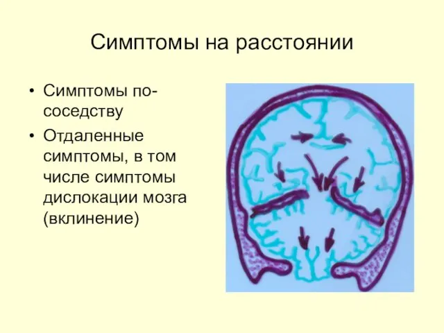 Симптомы на расстоянии Симптомы по-соседству Отдаленные симптомы, в том числе симптомы дислокации мозга (вклинение)