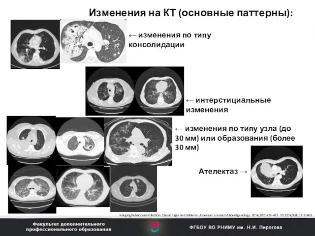 Изменения на КТ (основные паттерны): Imaging Pulmonary Infection: Classic Signs