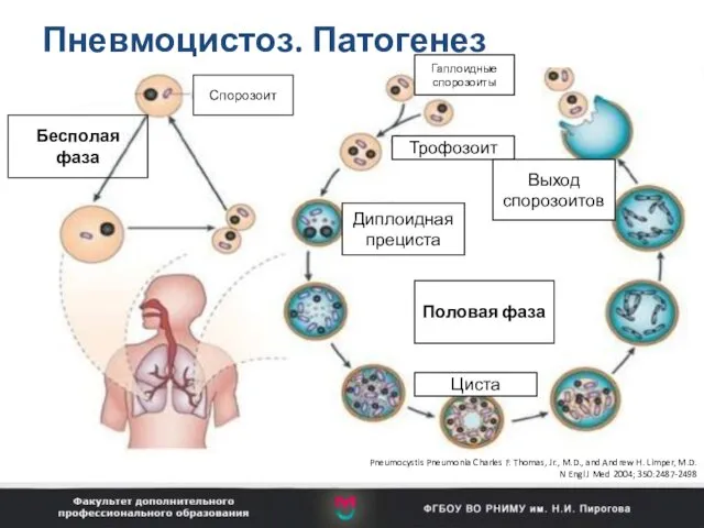 Пневмоцистоз. Патогенез Бесполая фаза Гаплоидные спорозоиты Трофозоит Диплоидная прециста Выход