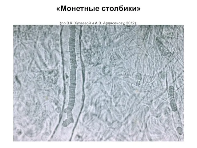 «Монетные столбики» (по В.К. Хугаевой и А.В. Ардасенову, 2012).