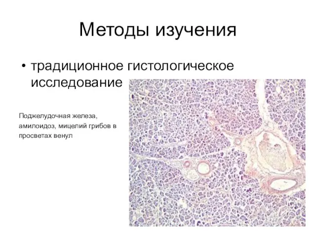 Методы изучения традиционное гистологическое исследование Поджелудочная железа, амилоидоз, мицелий грибов в просветах венул